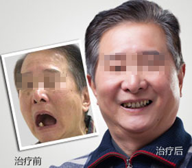 天津东丽区无痛人流医院