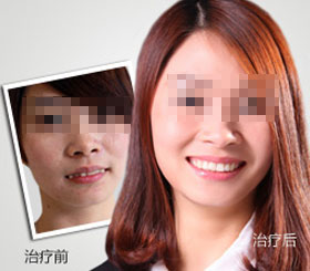 天津东丽区无痛人流医院