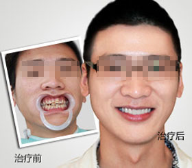天津东丽区无痛人流医院