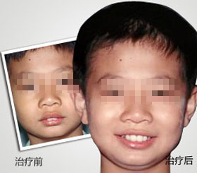 天津东丽区无痛人流医院